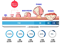 直肠癌早筛试剂盒“第一证”—足不出户而明察秋毫